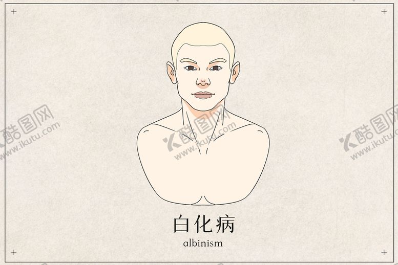 编号：61982409170321433572【酷图网】源文件下载-白化病