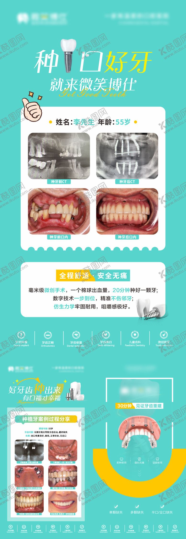 编号：17107909072356547735【酷图网】源文件下载-种植牙banner