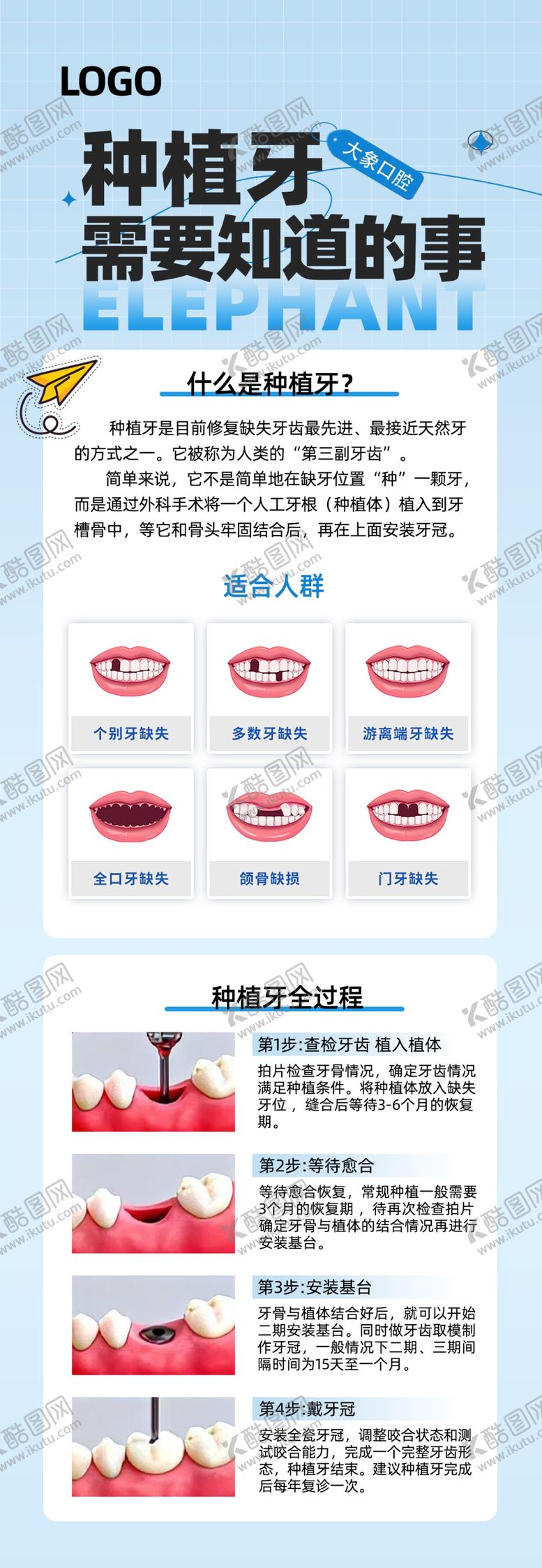 编号：46417505250846025825【酷图网】源文件下载-种植牙需要知道的事
