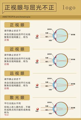 正视眼与屈光不正