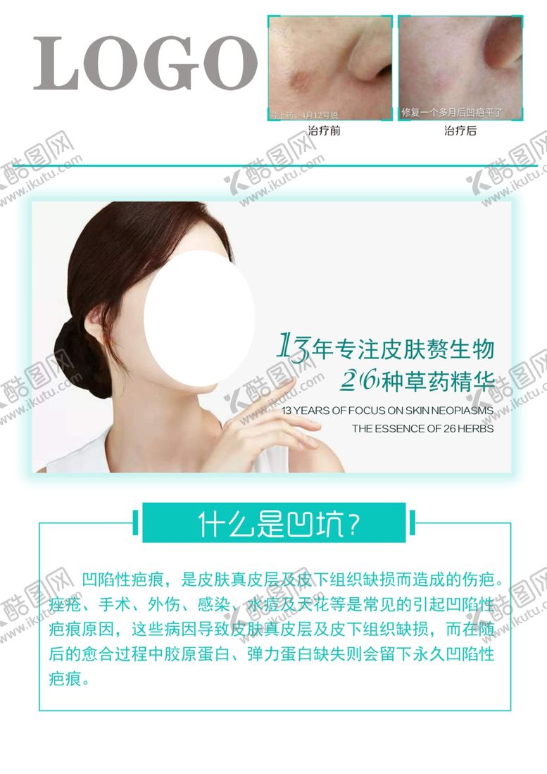 编号：70937207132240426190【酷图网】源文件下载-祛斑