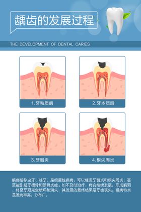 龋齿的发展过程