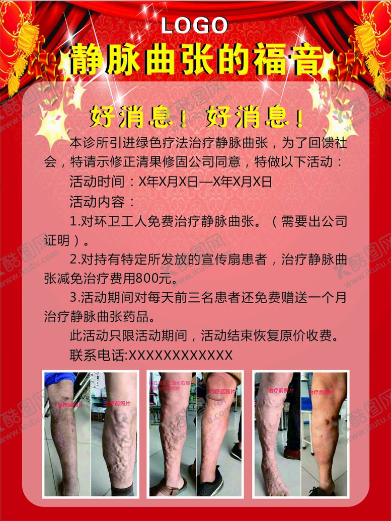 编号：30290001140715532931【酷图网】源文件下载-静脉曲张海报