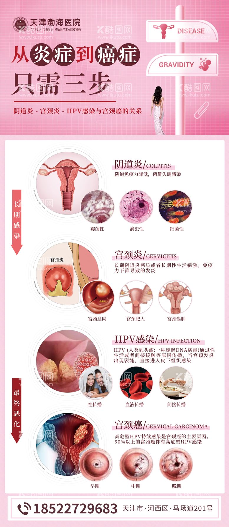 编号：46319811190520276839【酷图网】源文件下载-hpv妇科展架