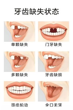 牙齿缺失缺损形态