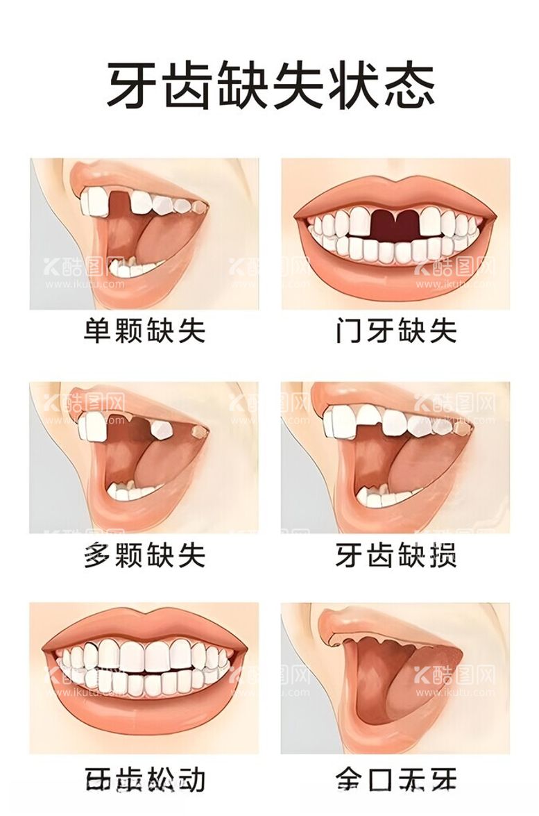 编号：84985412201805284510【酷图网】源文件下载-牙齿缺失缺损形态