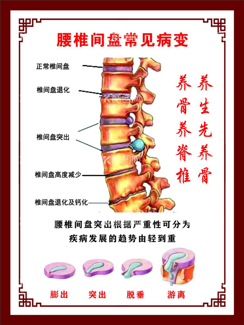 编号：36540610151029513344【酷图网】源文件下载-腰间盘突出