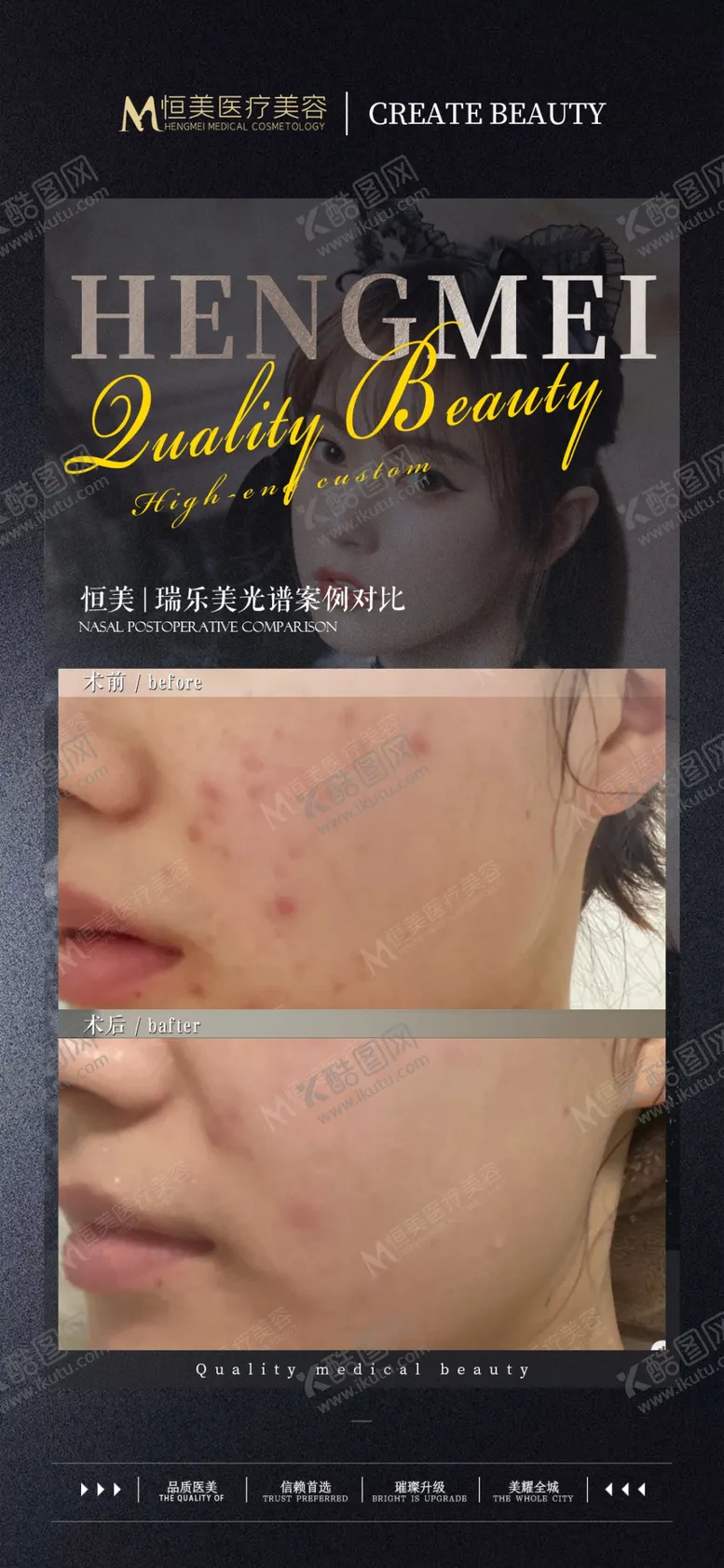 编号：29340701190342366091【酷图网】源文件下载-医美案例对比