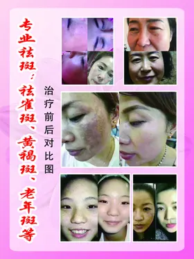 美容海报会所按摩spa植睫毛