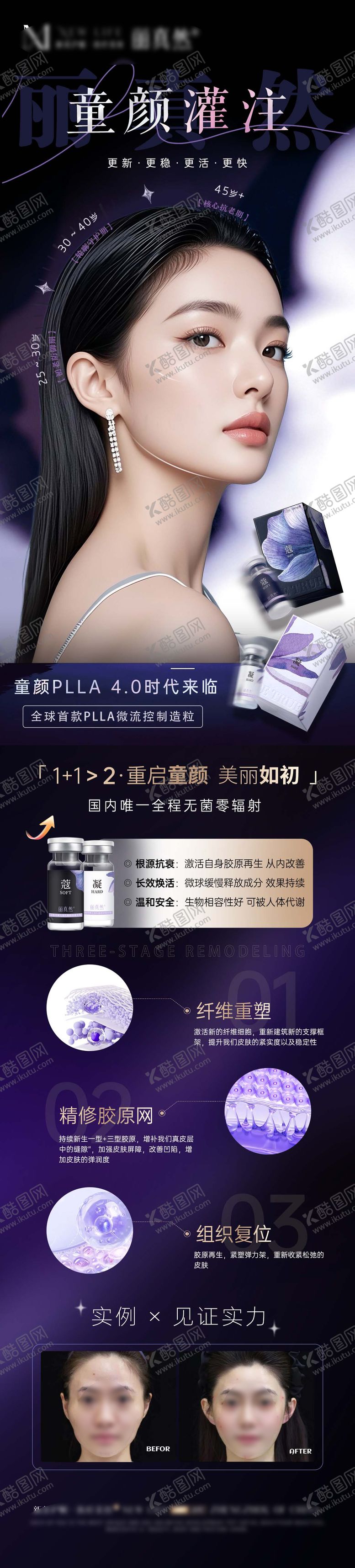 编号：36672203271405201621【酷图网】源文件下载-医美童颜灌注案例长图