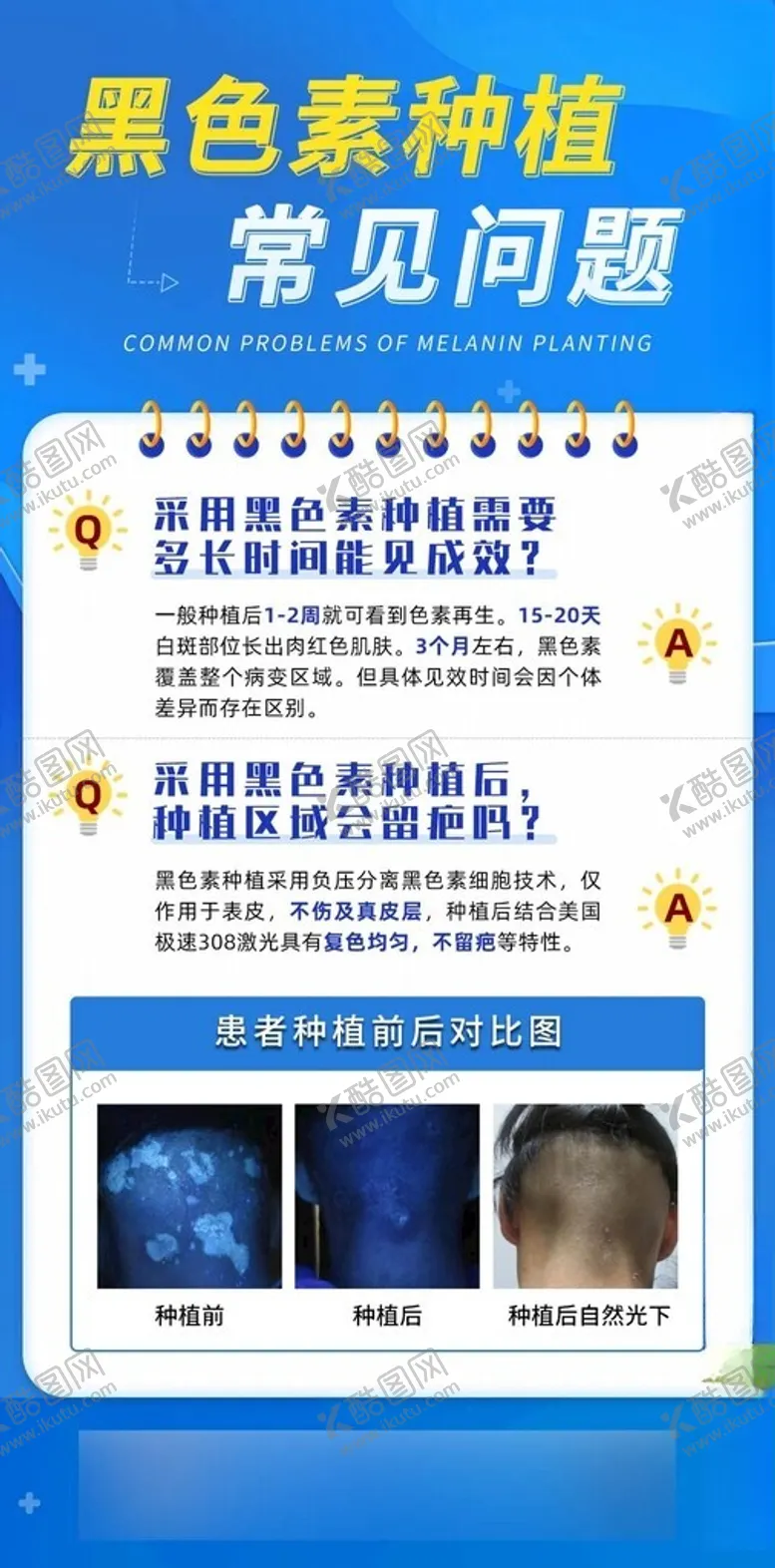 编号：35396301301111019999【酷图网】源文件下载-蓝色科普医疗黑色素介绍医用海报