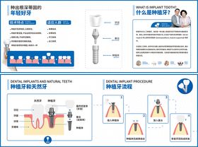 种植牙知识点诊室贴纸