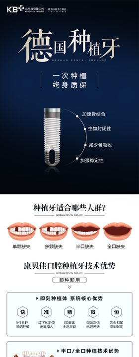 德国种植牙长图