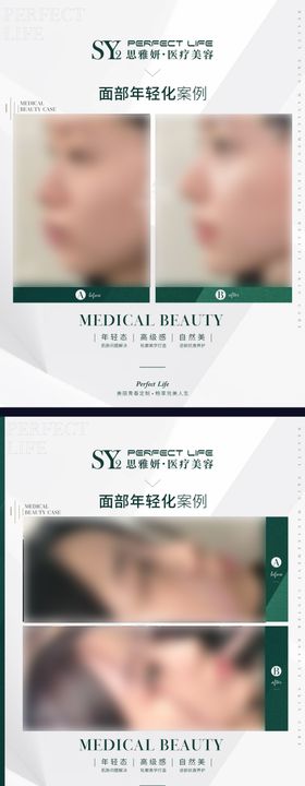 医美对比案例(TIF用PS打开)