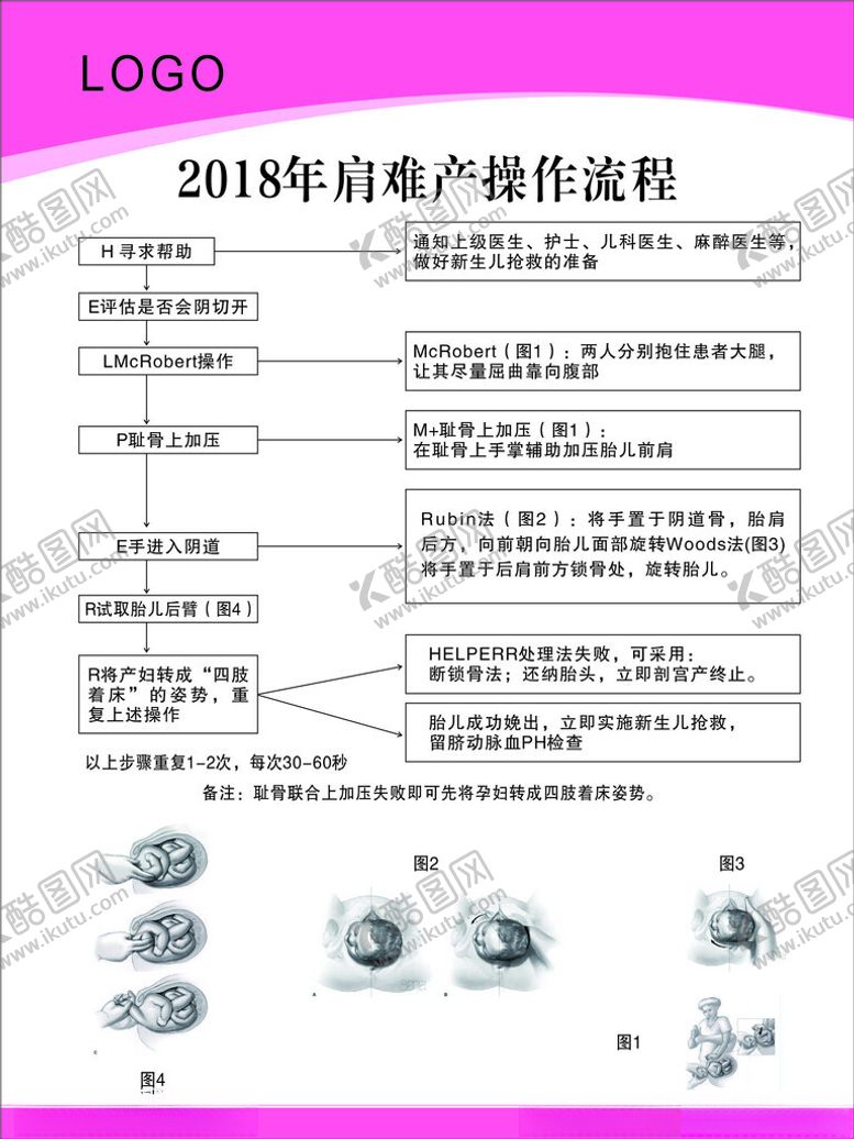 编号：74361101140600324739【酷图网】源文件下载-肩难产操作流程
