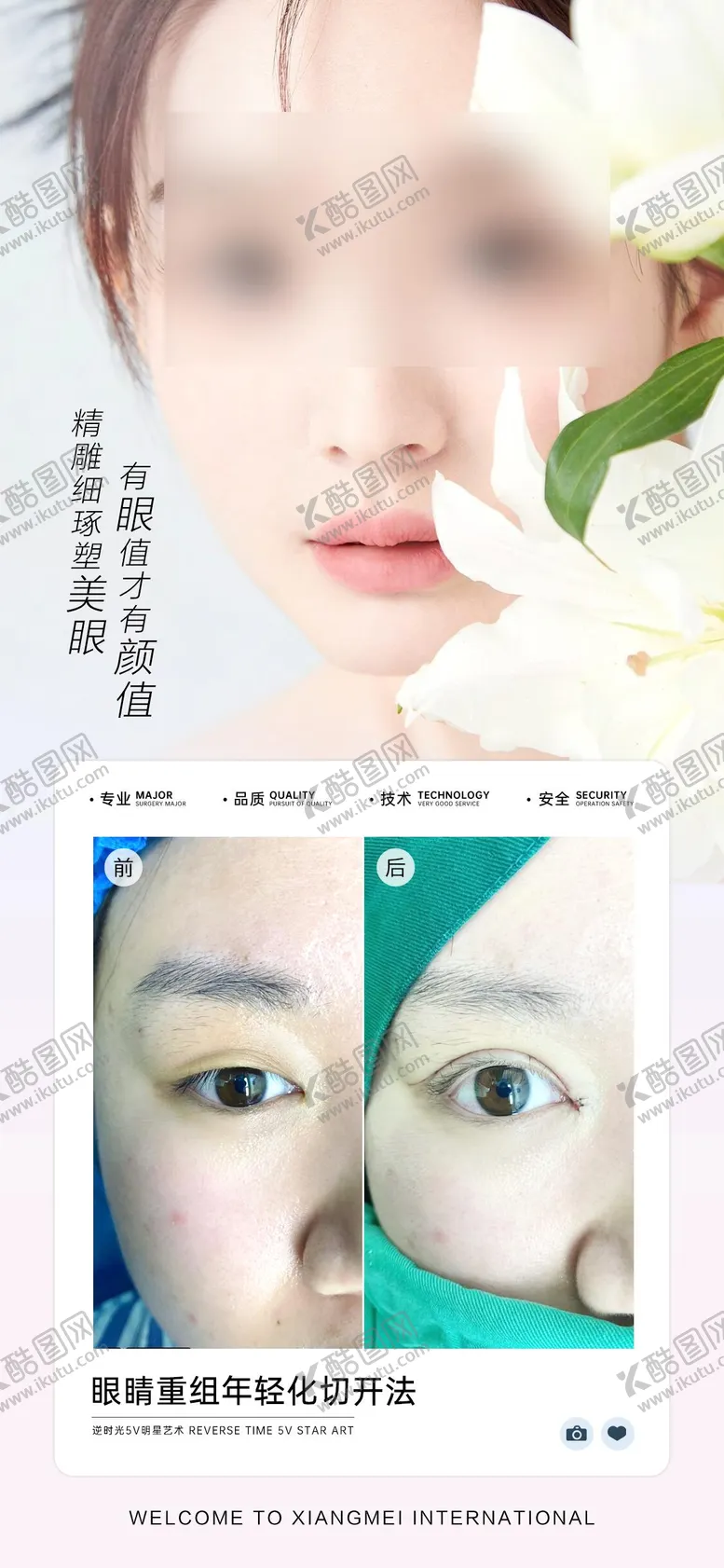 编号：18776101161021026514【酷图网】源文件下载-医美双眼皮案例对比海报