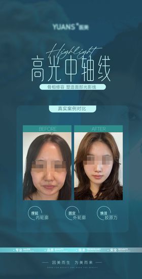 医美轮廓案例对比简约海报