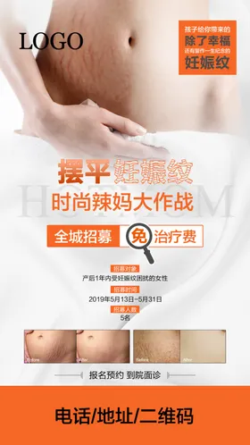 妊娠纹招募
