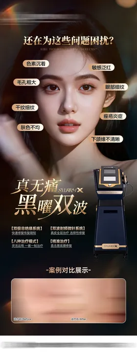 黑曜双波黄金全能针