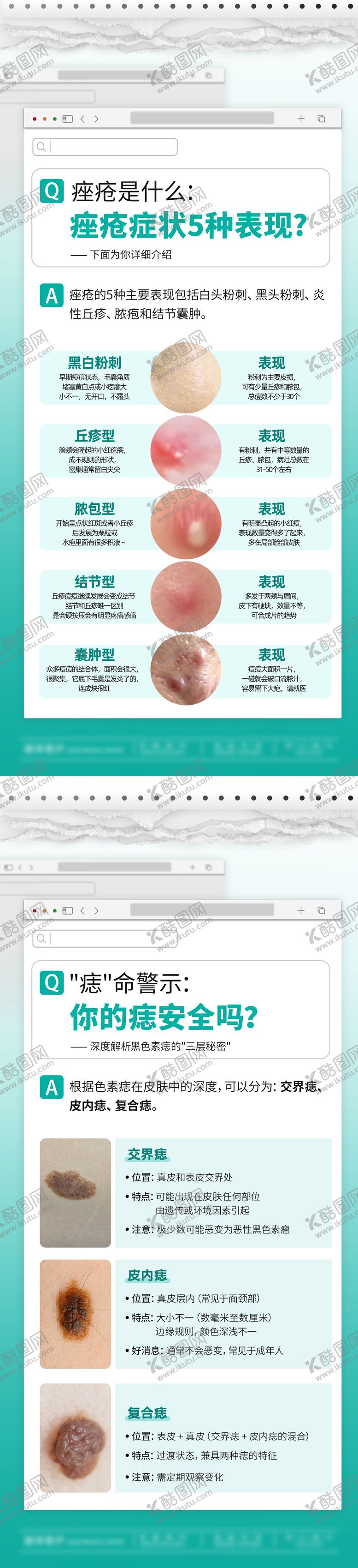 编号：41017611111530384783【酷图网】源文件下载-痤疮黑痣科普