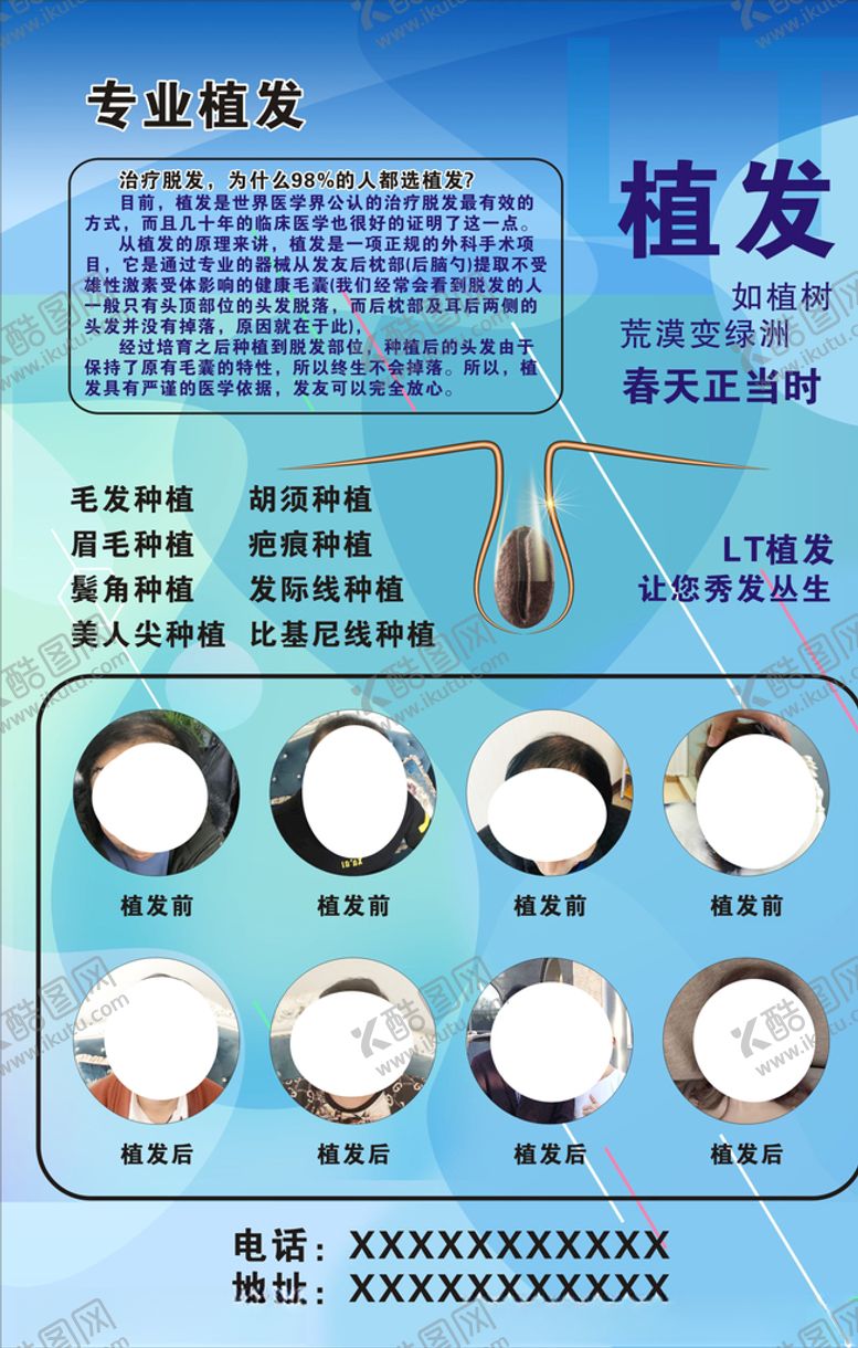 编号：13108909190508572227【酷图网】源文件下载-植发展板