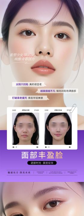 医美面部提升抗衰海报