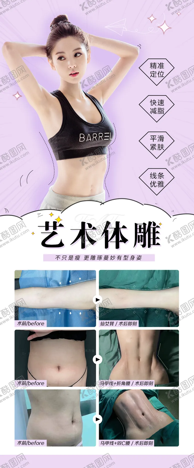 编号：54651112051531097098【酷图网】源文件下载-艺术体雕吸脂塑形整形案例