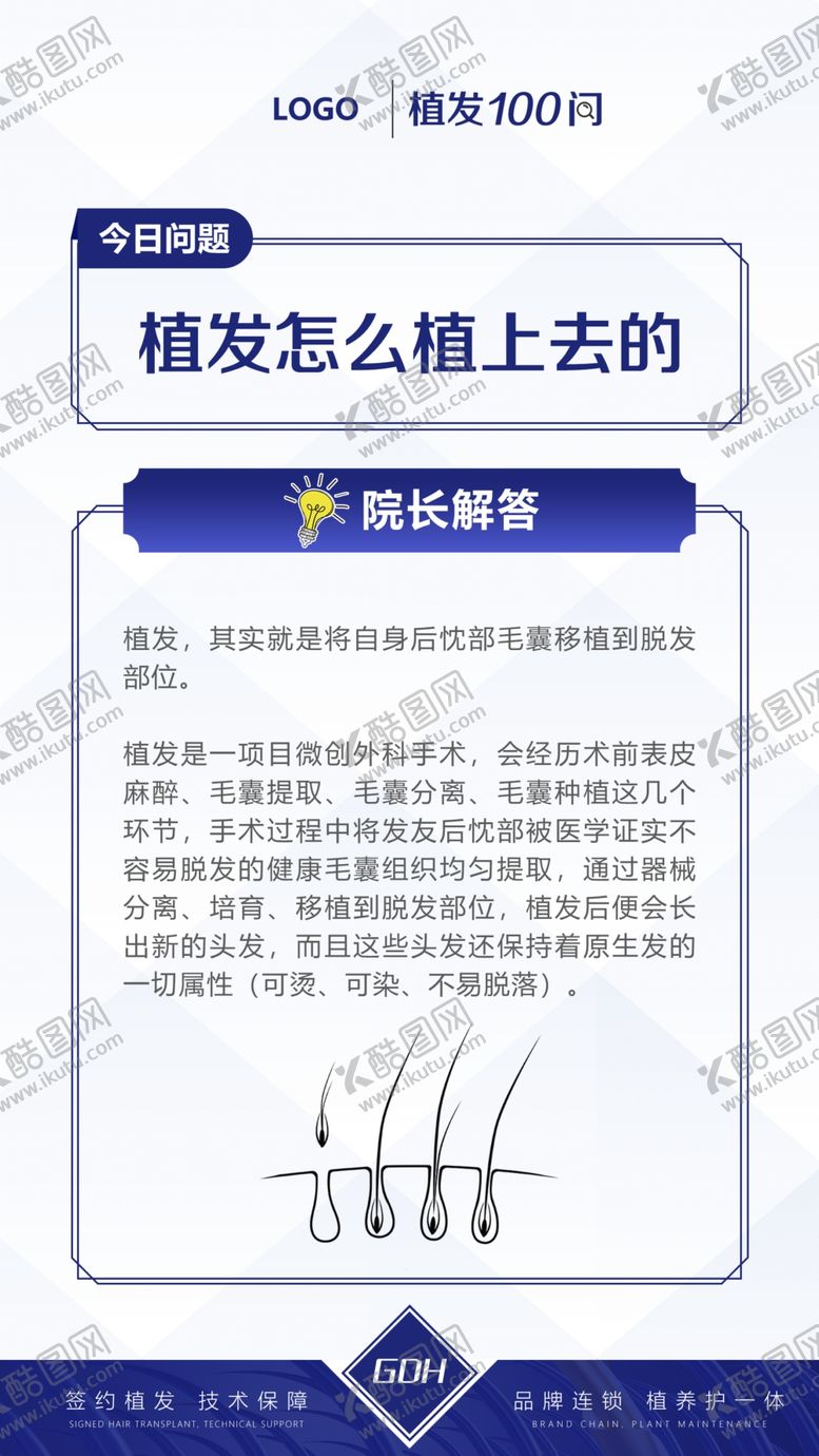 编号：65973209272043201209【酷图网】源文件下载-植发科普