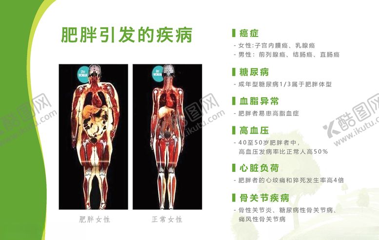 编号：96676207061946397546【酷图网】源文件下载-肥胖引起的疾病