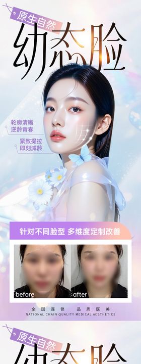 医美抗衰轮廓固定-原生自然幼态脸