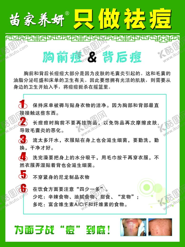 编号：17914105101537428278【酷图网】源文件下载-祛痘海报