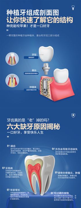 德国种植牙长图