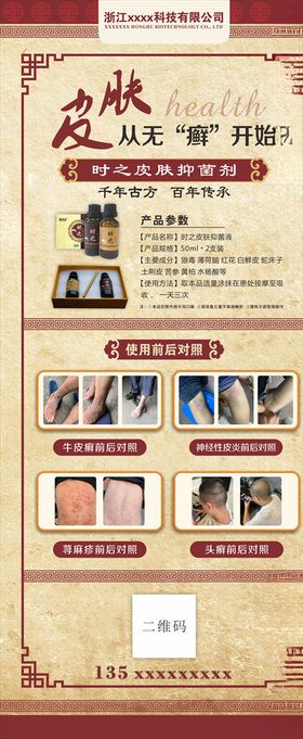 牛皮癣展架