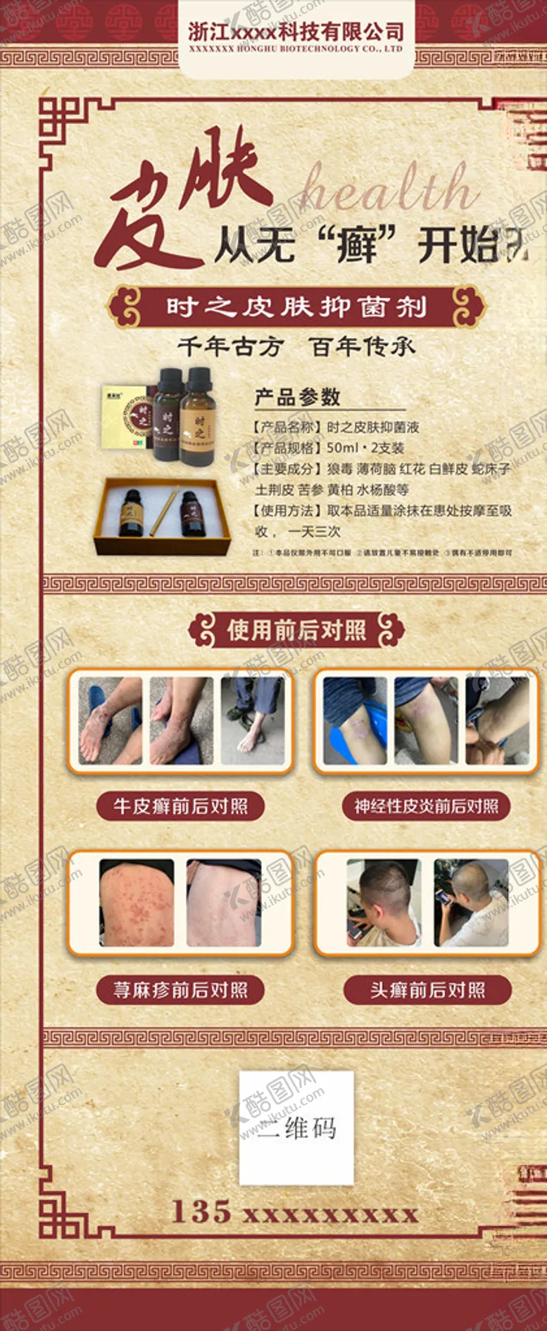 编号：17741806251512311970【酷图网】源文件下载-牛皮癣展架