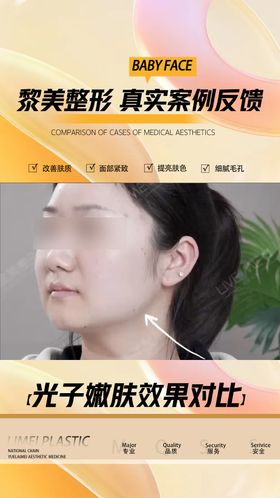 医美视频框