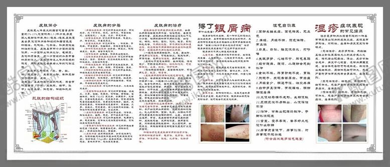 编号：57980302151611016127【酷图网】源文件下载-皮肤病简介治疗展板