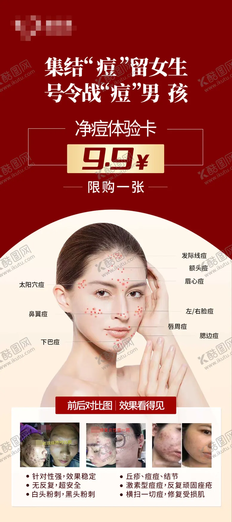 编号：90166006301951544309【酷图网】源文件下载-祛痘红色展架医美祛痘海报