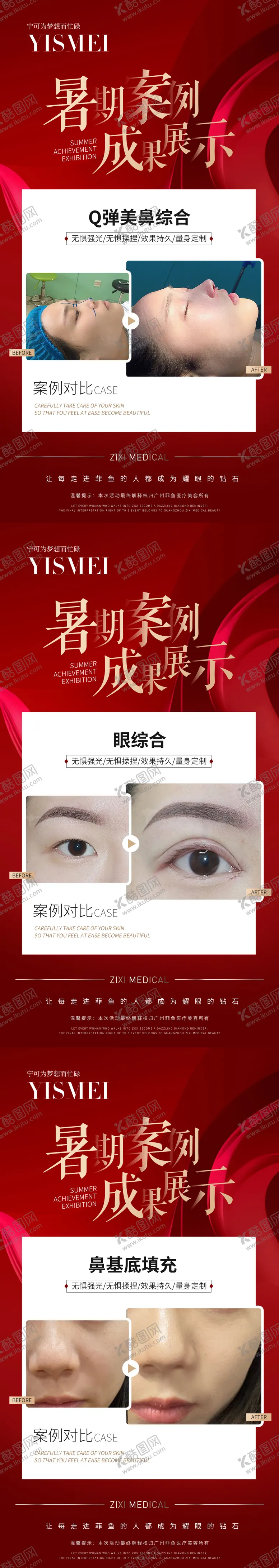 编号：71366011231006225601【酷图网】源文件下载-医美暑期案例