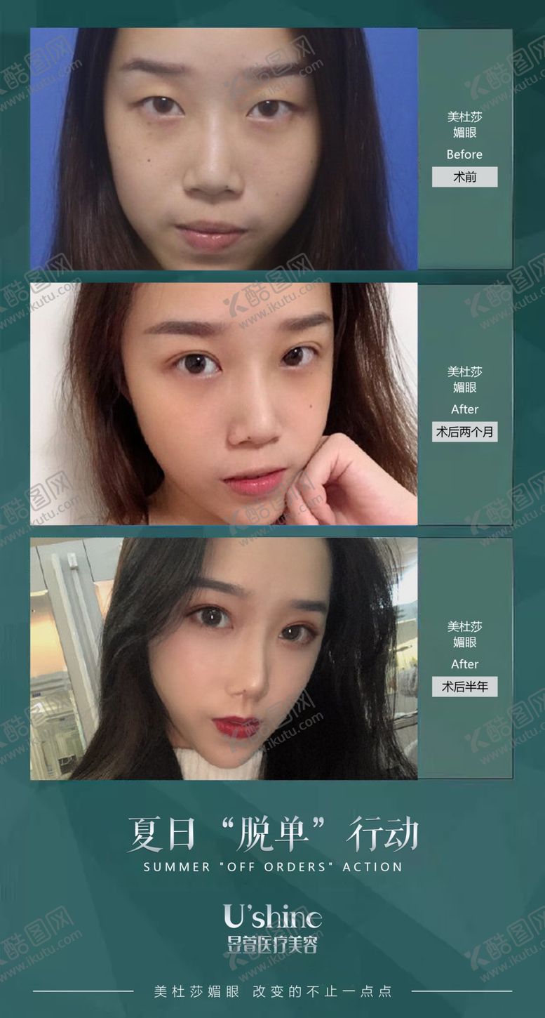 编号：25820009200905114431【酷图网】源文件下载-医美整形医院案例对比海报