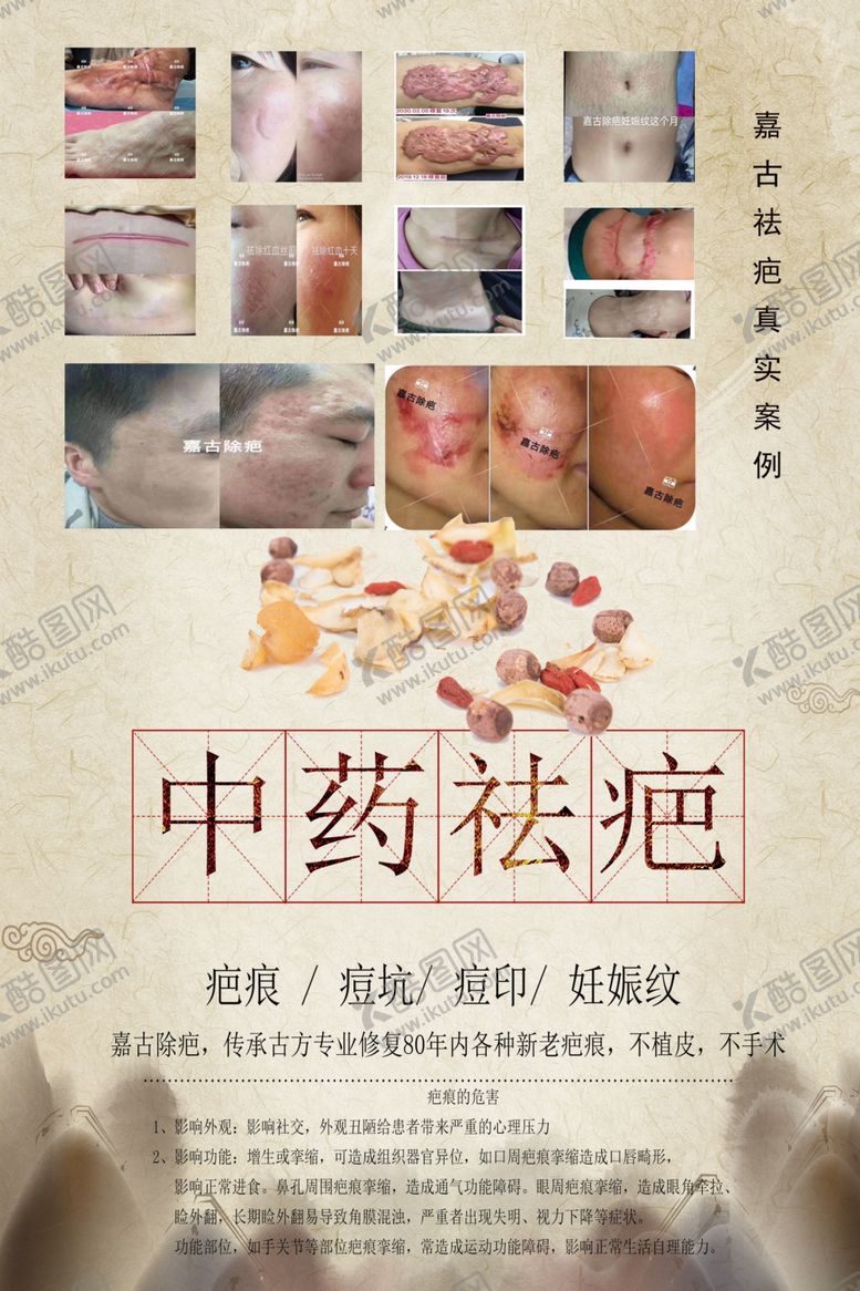 编号：93687204292331574166【酷图网】源文件下载-祛痘除疤