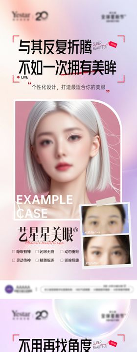 医美整形外科双眼皮案例对比图套图