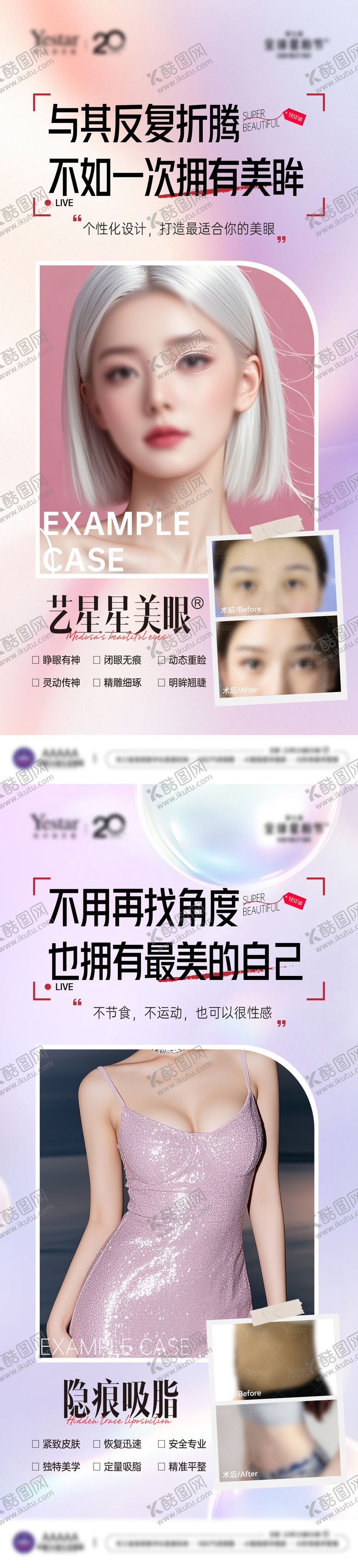 编号：15819812151337105656【酷图网】源文件下载-医美整形外科双眼皮案例对比图套图