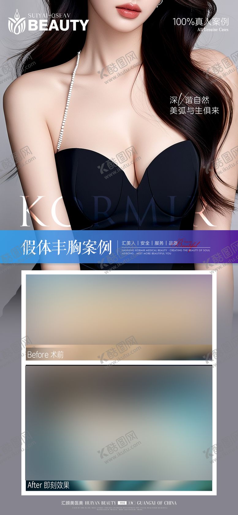 编号：15858011251652212351【酷图网】源文件下载-丰胸案例