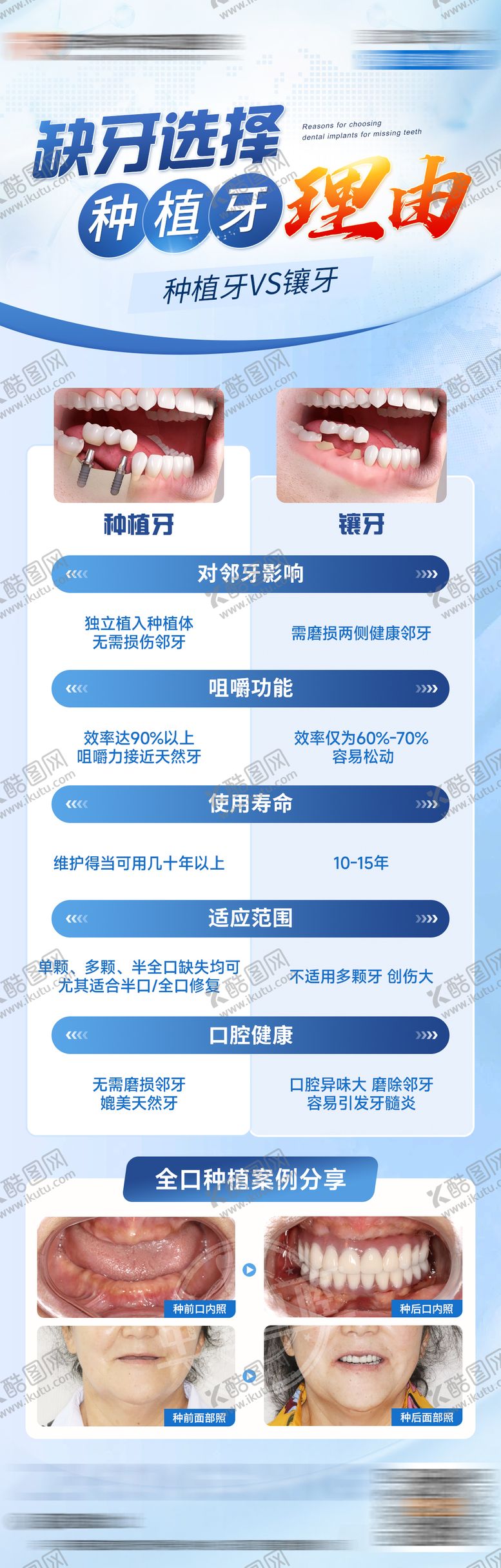 编号：14625412261741543886【酷图网】源文件下载-缺牙选择种植牙的理由