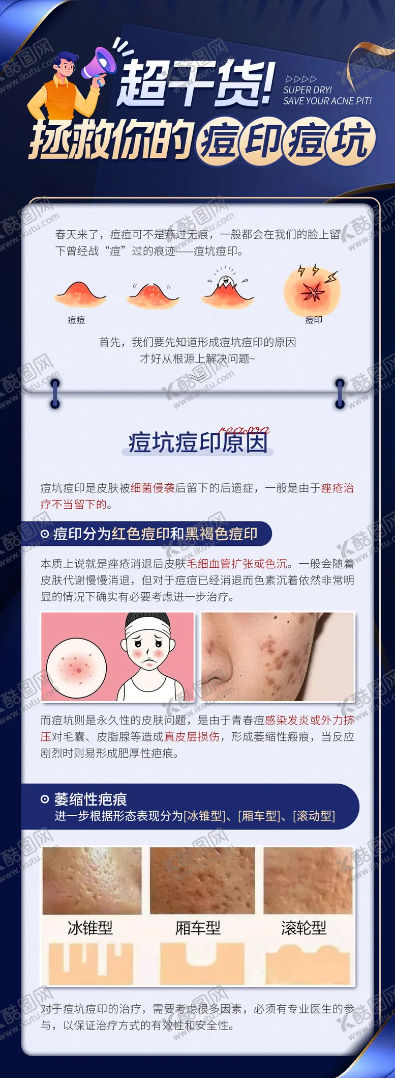 编号：31187511211708444621【酷图网】源文件下载-拯救你的痘印痘坑长图海报