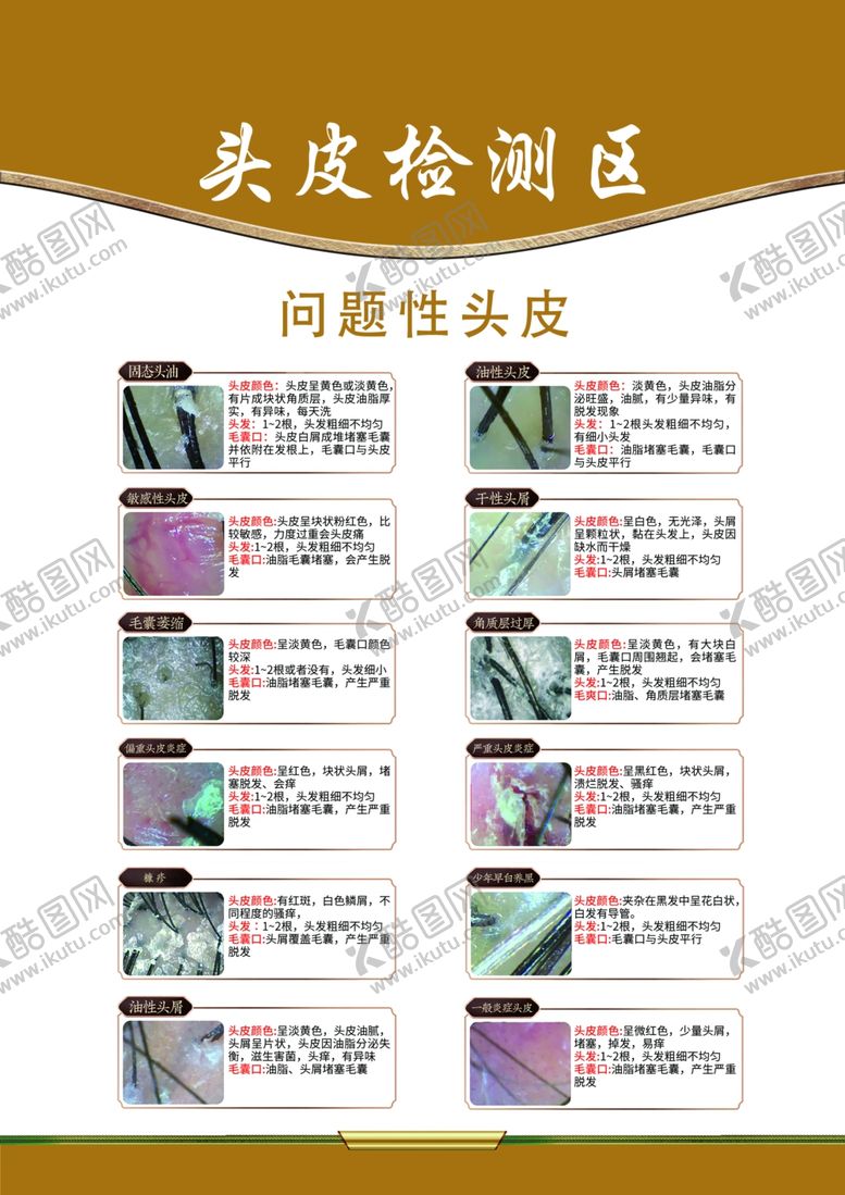 编号：70594912041716582424【酷图网】源文件下载-头皮问题