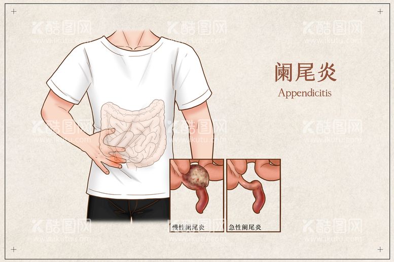 编号：48645211031021246914【酷图网】源文件下载-阑尾炎