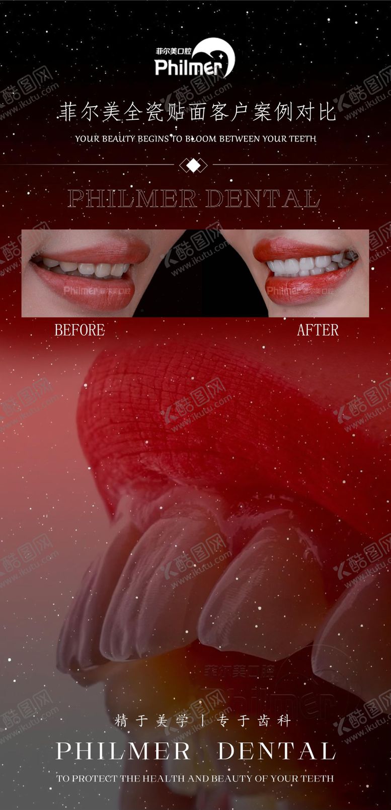 编号：83766811241705413956【酷图网】源文件下载-口腔牙贴面海报