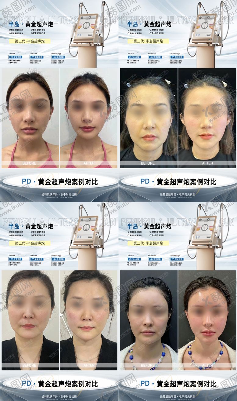 编号：60960102051116019212【酷图网】源文件下载-超声炮海报