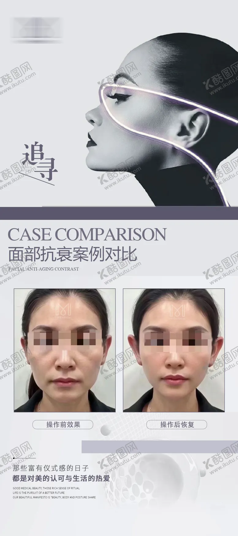 编号：57443502171154305541【酷图网】源文件下载-医美案例美业案例对比海报